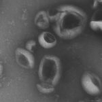 Study: Mechanism of fibrosis development discovered — (Details)