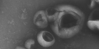 Study: Mechanism of fibrosis development discovered — (Details)