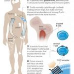 Study: A mysterious lack of T-cells has hindered the immune system’s ability to fight glioblastoma — (Details)