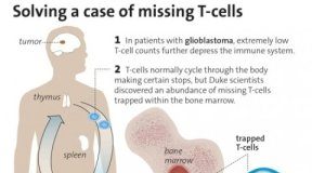 Study: A mysterious lack of T-cells has hindered the immune system’s ability to fight glioblastoma — (Details)