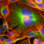 Study: First study on physical properties of giant cancer cells may inform new treatments — (Details)