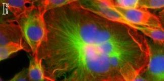 Study: First study on physical properties of giant cancer cells may inform new treatments — (Details)