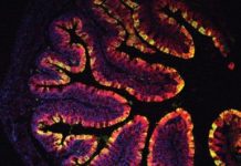 Research: Chemicals found in vegetables prevent colon cancer in mice —