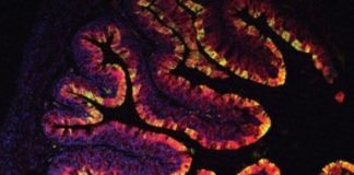 Research: Chemicals found in vegetables prevent colon cancer in mice —