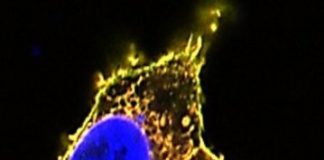 Study: Miscarriage cause, key cellular targets of potential drugs, revealed in new research — (Details)