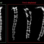 Study: Autism linked to egg cells’ difficulty creating large proteins — (Details)