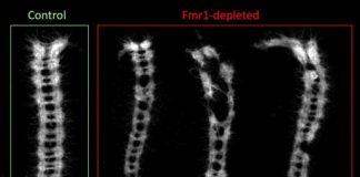 Study: Autism linked to egg cells’ difficulty creating large proteins — (Details)