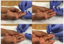 Research: Whole blood test for toxoplasmosis is sensitive, specific —