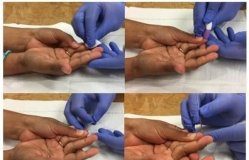 Research: Whole blood test for toxoplasmosis is sensitive, specific —