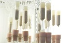 Tech: Enzyme could help accelerate biofuel production — (Report)