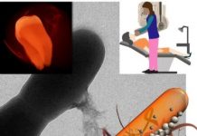 Research: Novel nanoparticle-based approach detects and treats oral plaque without drugs —