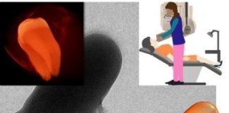 Research: Novel nanoparticle-based approach detects and treats oral plaque without drugs —