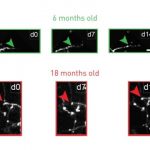 Study: Antidepressant restores youthful flexibility to aging inhibitory neurons in mice — (Details)