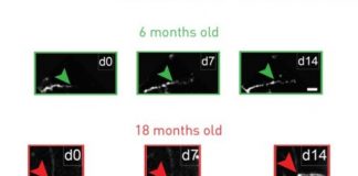 Study: Antidepressant restores youthful flexibility to aging inhibitory neurons in mice — (Details)