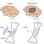 Study: Brain cancer potentially resists immunotherapies by trapping T cells in bone marrow — (Details)