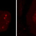 Study: Discovery may lead to new ways of diagnosing and treating both diseases — (Details)