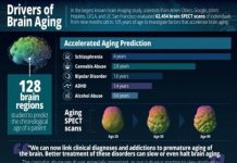 Research: Schizophrenia, cannabis use, and alcohol abuse are just several disorders that are related to accelerated brain aging —