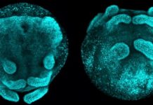 Research: A common ancestral gene causes body segmentation in spiders and insects —