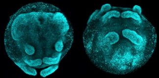 Research: A common ancestral gene causes body segmentation in spiders and insects —