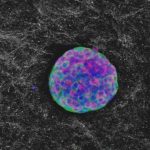 Study: New type 1 diabetes therapy shows promise for long-term reversal in both humans, dogs — (Details)