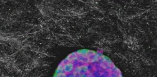 Study: New type 1 diabetes therapy shows promise for long-term reversal in both humans, dogs — (Details)