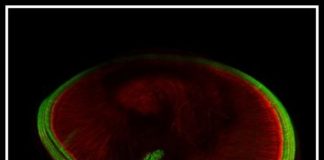 Study: Ending a 40-year quest, scientists reveal the identity of ‘hearing’ protein — (Details)