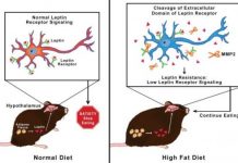 Research: A destructive mechanism that blocks the brain from knowing when to stop eating —