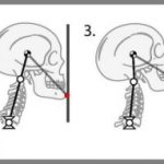 Study: Head and neck positioning affects concussion risk — (Details)