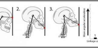 Study: Head and neck positioning affects concussion risk — (Details)
