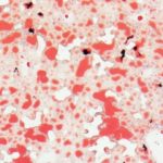 Study: Trehalose blocks glucose from liver — (Details)