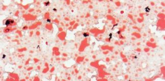 Study: Trehalose blocks glucose from liver — (Details)