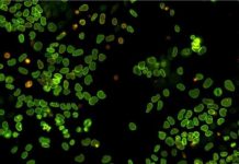 Research: The birth and death of proteins in a single cell —