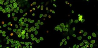 Research: The birth and death of proteins in a single cell —