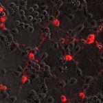 Study: How rabies virus moves through nerve cells, and how it might be stopped — (Details)