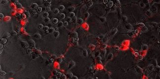 Study: How rabies virus moves through nerve cells, and how it might be stopped — (Details)