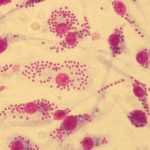 Study: Researchers in medicinal chemistry and parasitology develop an innovative strategy to identify leishmanicidal molecules — (Details)