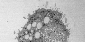 Study: How the cholera bacterium survives water predators — (Details)