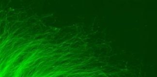 Study: Research improves screening of experimental therapies for neurodegenerative disease — (Details)