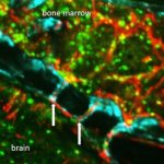Study: Study suggests immune cells rush through channels to get to injured tissue quickly — (Details)