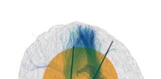 Study: Improved effects on motor function and fewer side effects possible — (Details)