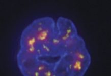 Research: Researchers develop ‘cytological ruler’ to build 3D map of human genome —