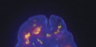 Research: Researchers develop ‘cytological ruler’ to build 3D map of human genome —