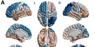 Study: When it comes to weight gain, the problem may be mostly in our heads, and our genes — (Details)