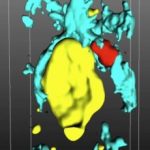 Study: When neurons turn against themselves — (Details)