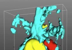 Study: When neurons turn against themselves — (Details)