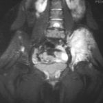 Study: Complex genetic rearrangements found which could inform treatment — (Details)