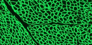 Research: CRISPR halts Duchenne muscular dystrophy progression in dogs —