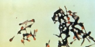 Study: Study illustrates challenges of lowering tetanus mortality — (Details)