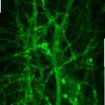 Study: Now we can see brain cells ‘talk’ and that will shed light on neurological diseases — (Details)