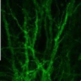 Study: Now we can see brain cells ‘talk’ and that will shed light on neurological diseases — (Details)